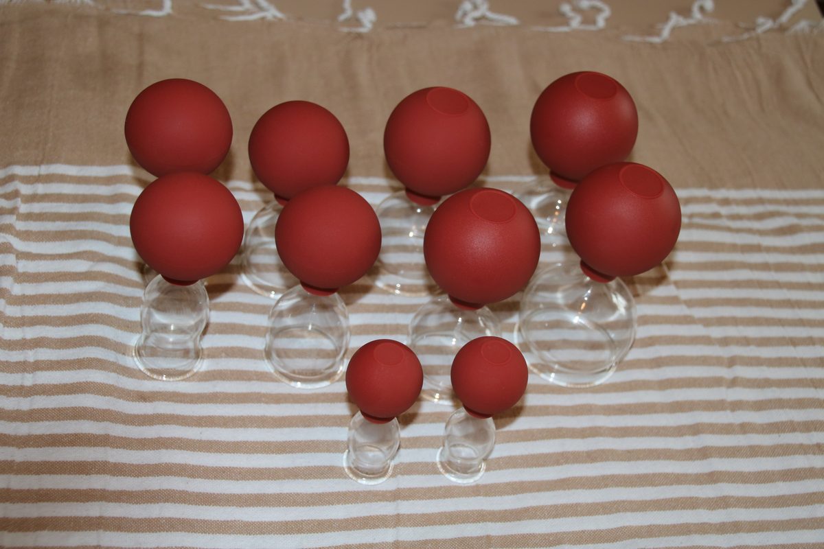 Schr&ouml;pfmassage Kurs &ndash; Teilnehmer &uuml;bt Schr&ouml;pfgl&auml;ser-Technik