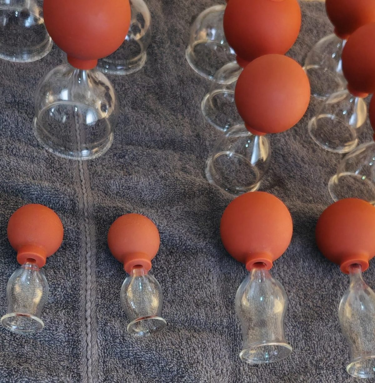 Schröpfgläser-Set – verschiedene Größen für den Kurs