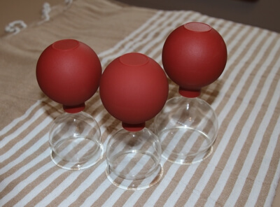 Schr&ouml;pfgl&auml;ser auf dem R&uuml;cken &ndash; Schr&ouml;pfmassage Kurs